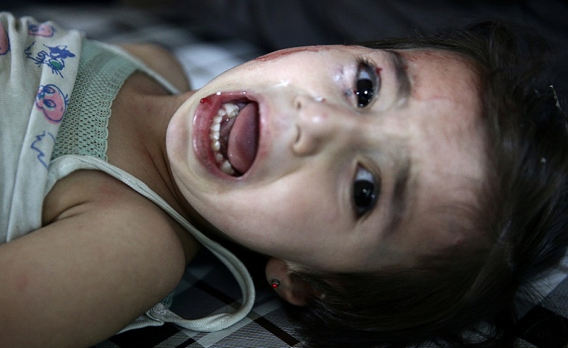 وأطفال في المستشفى يتلقون العلاج اثر غارة جوية في دمشق. الصور وكالات