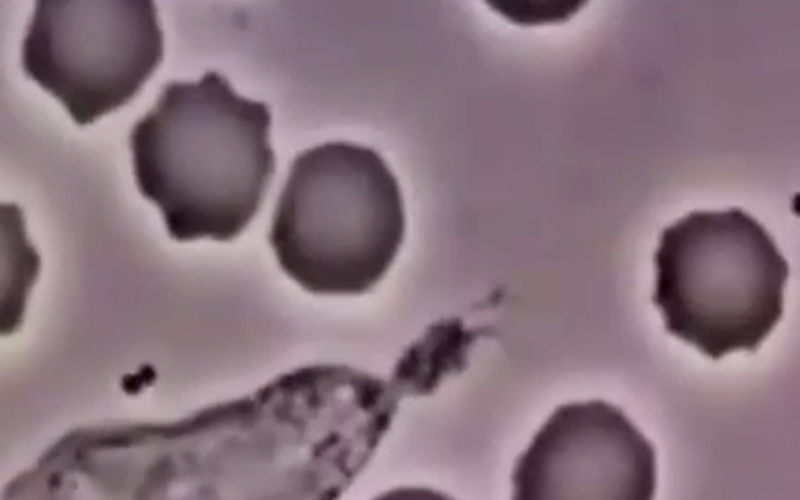 بالفيديو.. خلايا الدم البيضاء تطارد البكتيريا وتأكلها