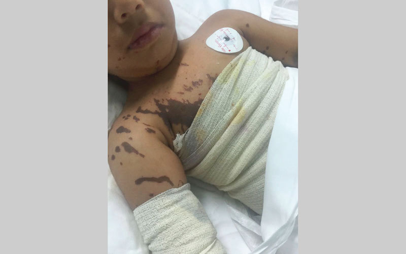 «عبدالرحمن» تلقى العلاج في مستشفى لطيفة لمدة شهر. من المصدر