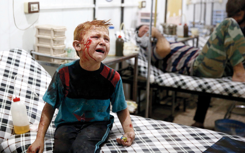 طفل سوري أصيب في قصف للنظام على بلدة دوما.  أرشيفية