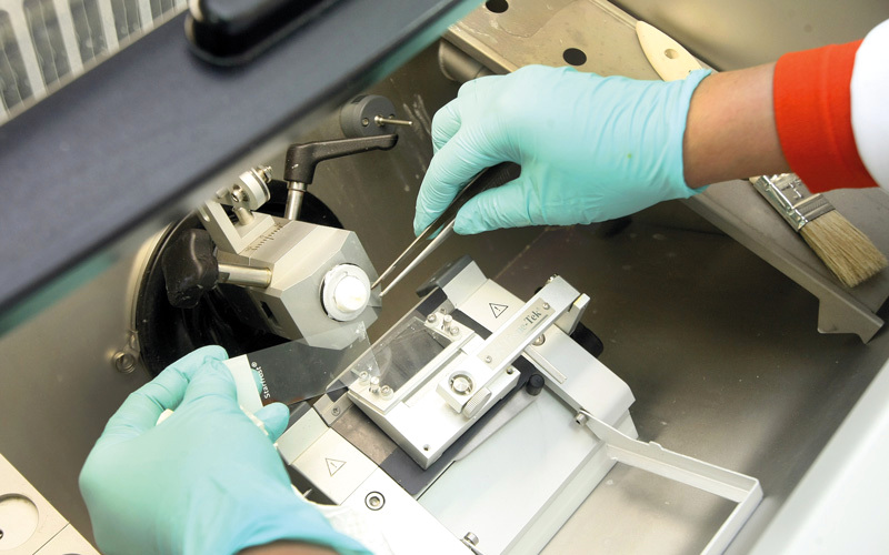 مبادرات «برنامج مكافحة السرطان» تشمل تنظيم حملات توعية ووضع سياسات داعمة لأنماط الحياة الصحية السليمة. أرشيفية