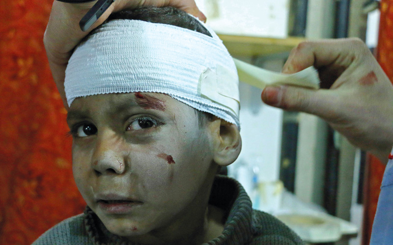 طفل يتلقى العلاج عقب إصابته في غارات للنظام على الغوطة الشرقية. أ.ف.ب