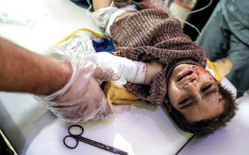 طفل جريح يعالَج في مستشفى مؤقت بعد إصابته بغارة جوية لقوات النظام. أ.ف.ب