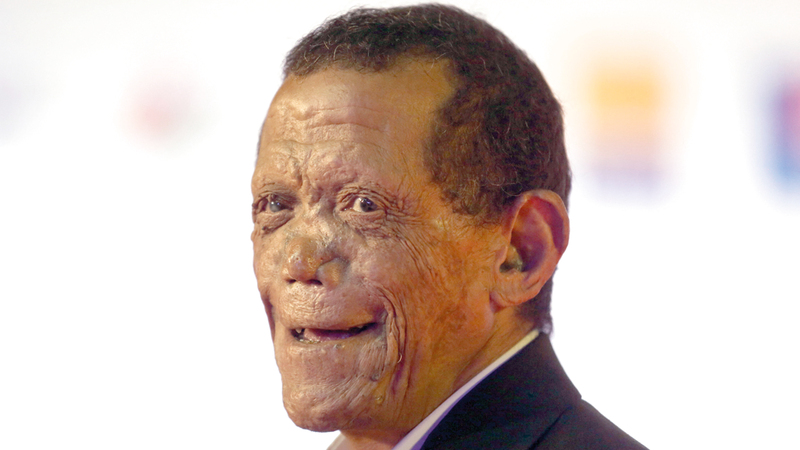 بطل الفيلم راضي جمال شخصية حقيقية كانت مصابة بالجذام وشفيت. أ.ف.ب