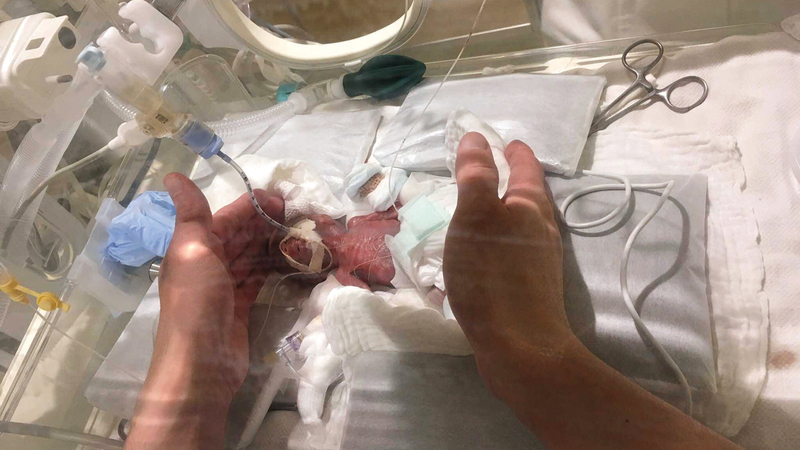 268 غراماً كان وزن الرضيع حين الولادة.  رويترز