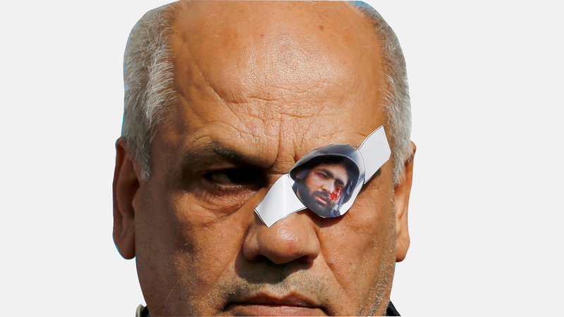 المصور الصحافي معاذ عمارنة أصيب بعيار مطاطي إسرائيلي في عينه اليسرى. رويترز