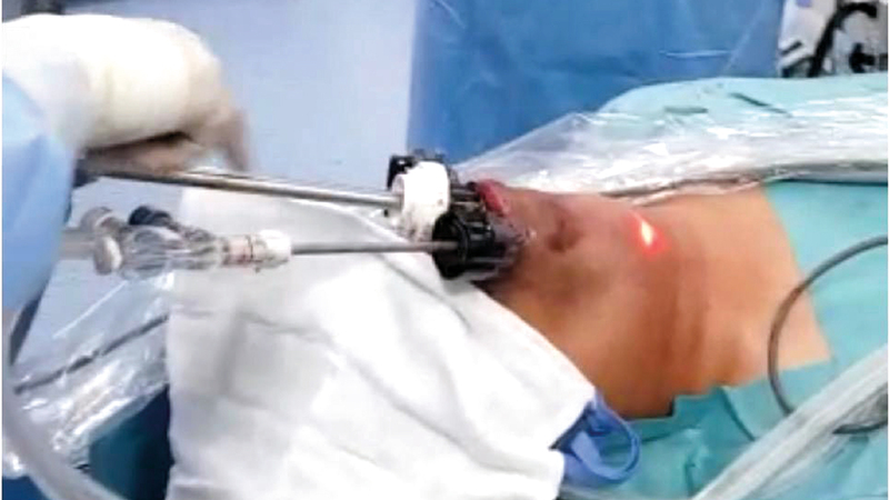 المريض غادر المستشفى خلال 48 ساعة.

من المصدر