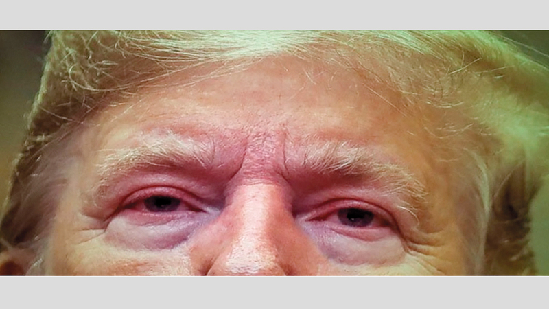 تأثير عقار الأديرال على عيني ترامب. ■ غيتي
