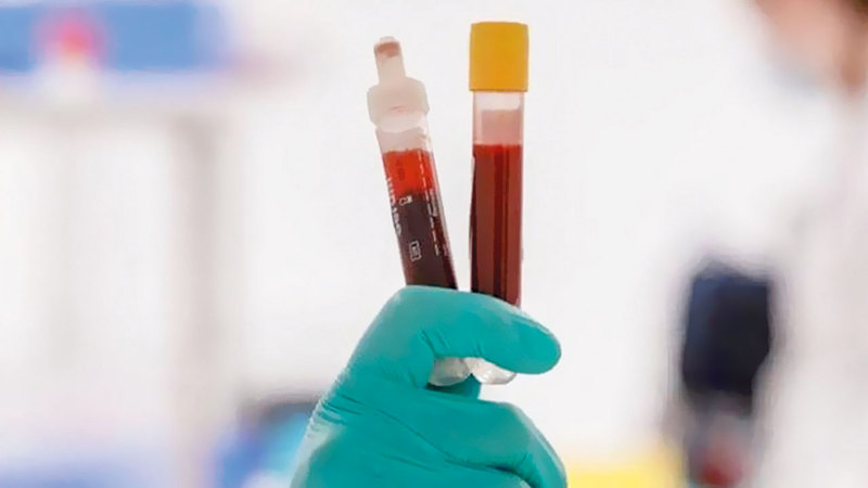عشرات شركات التقنية الحيوية ومختبرات الأبحاث سارعت إلى إنتاج اختبارات الدم. ■من المصدر