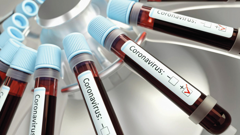 السباق على اللقاح قد لا يكون مفيداً لأنه سيقود البعض إلى نتائج غير موضوعية.   أرشيفية