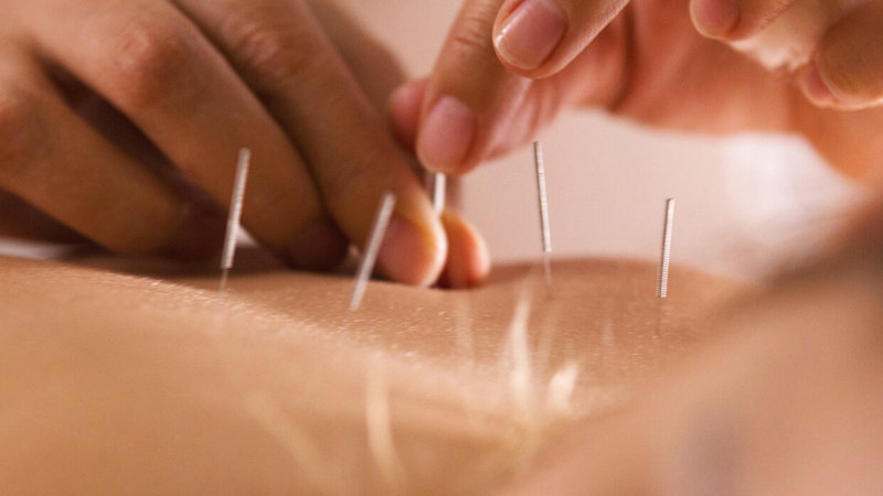 معظم المقبلين على الطب البديل ممن يعانون أمراضاً مناعية مزمنة. ■أرشيفية