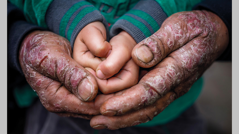 محمد عبداللطيف محمود - مصر.