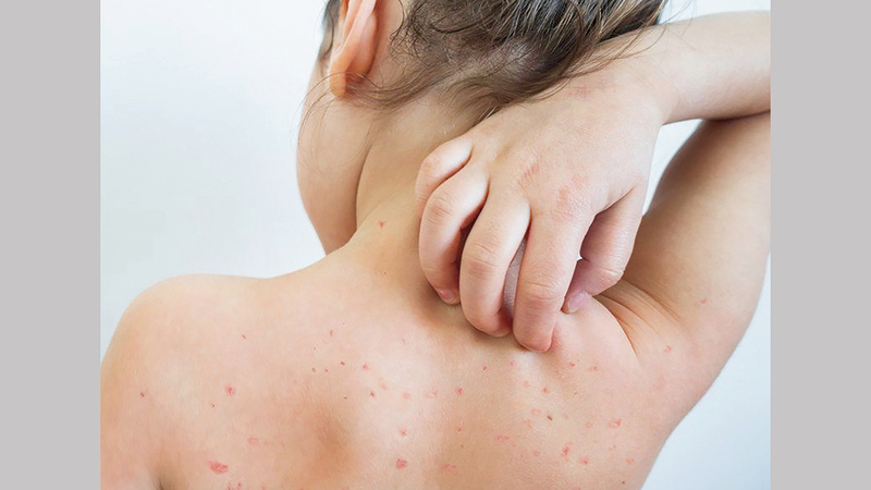 عندما تنتهي أزمة فيروس «كورونا» من الممكن أن تفاجئنا الأمراض الأكثر خطورة بالعودة من جديد بصورة عنيفة.  أرشيفية