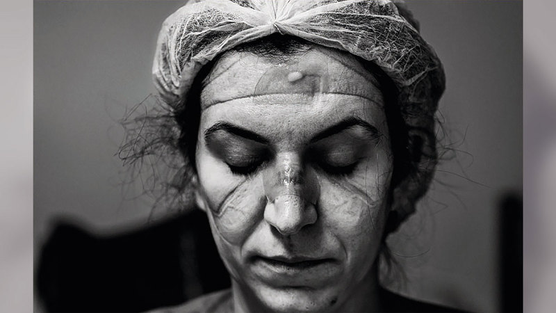 صورة الفنان البرازيلي آري باسوس، تعرض الدكتورة جوليانا ريبيرو بعد ثماني ساعات من العمل المتواصل في غرفة الطوارئ الخاصة بالمصابين بفيروس كورونا، وتبرز العدسة الآثار على وجهها وما يرويه من قصص إنسانية مؤلمة أوجعت العالم بأسره.  من المصدر