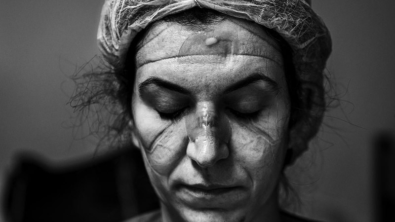 آري باسوس - البرازيل.