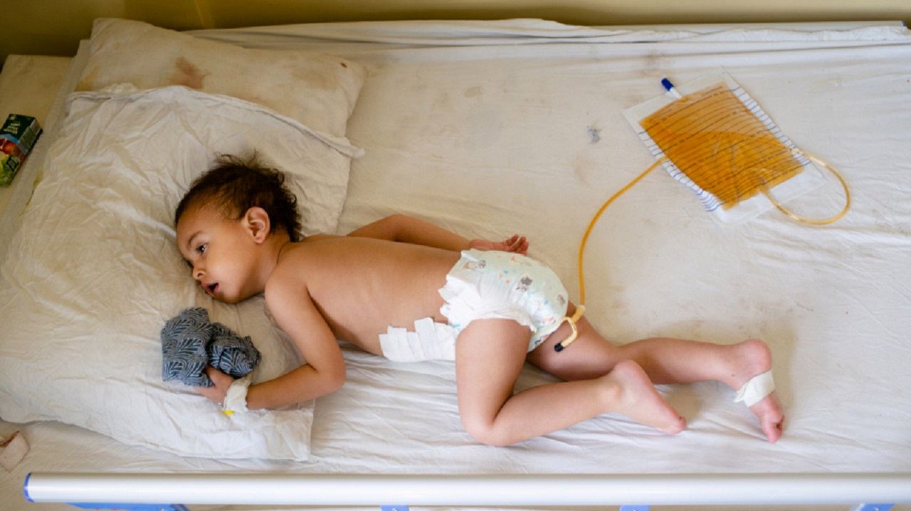 الأطباء أزالوا شظايا من بطن الطفل الأفغاني