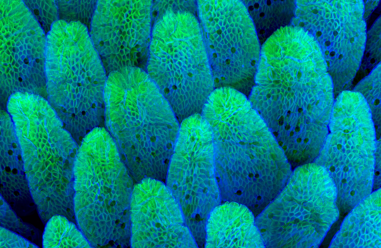 زغابات تغلف بطانة الأمعاء لأحد الفئران التي تظهر بتكبير 63 مرة