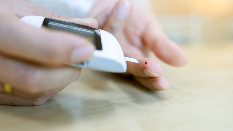 ينصح الأطباء بضرورة إجراء الفحص الدوري لرصد أي بدايات للمرض.   أرشيفية