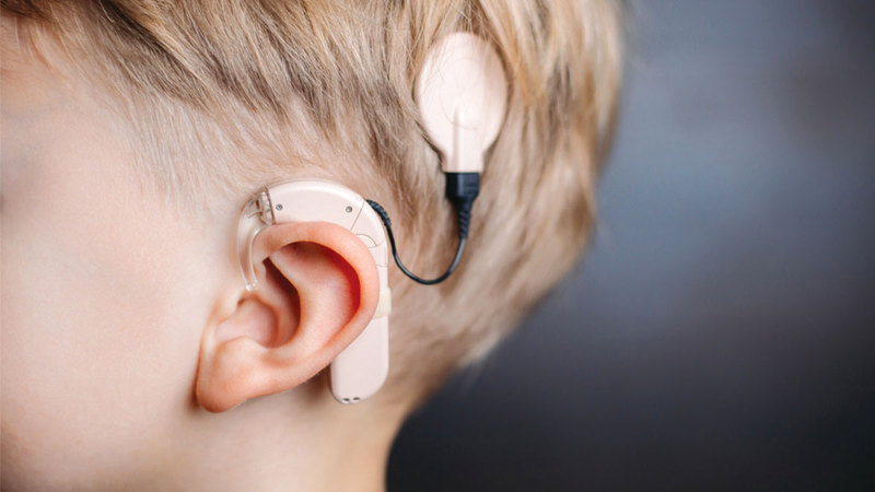 عمليات زراعة القوقعة تشمل مرحلة إعادة التأهيل للأطفال.	   من المصدر