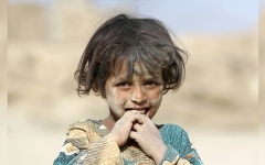 الصورة: تزايد عدد الأطفال الأفغان الذين يعانون الجوع