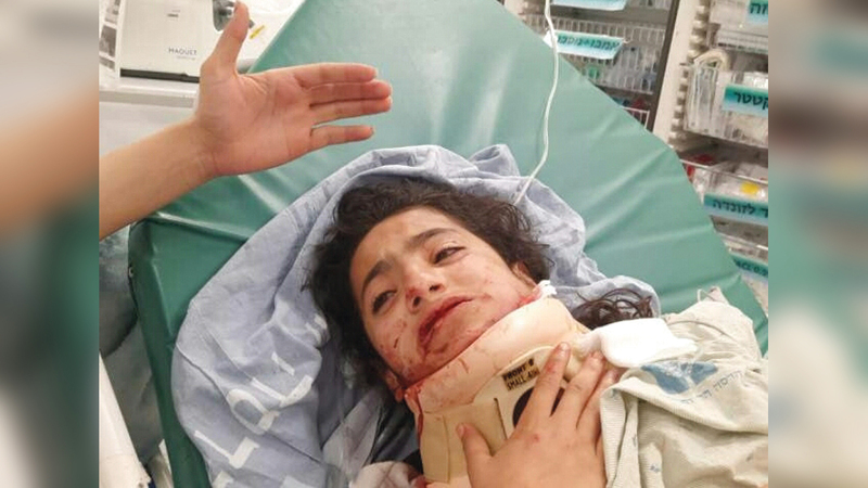 إصابة «منور» تسببت لها بحالة نفسية مستعصية.   الإمارات اليوم