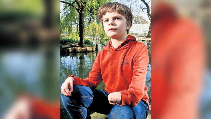 سباستيان يعاني تشوّهات في اليدين جرّاء عقار فالبروات الصوديوم.  من المصدر