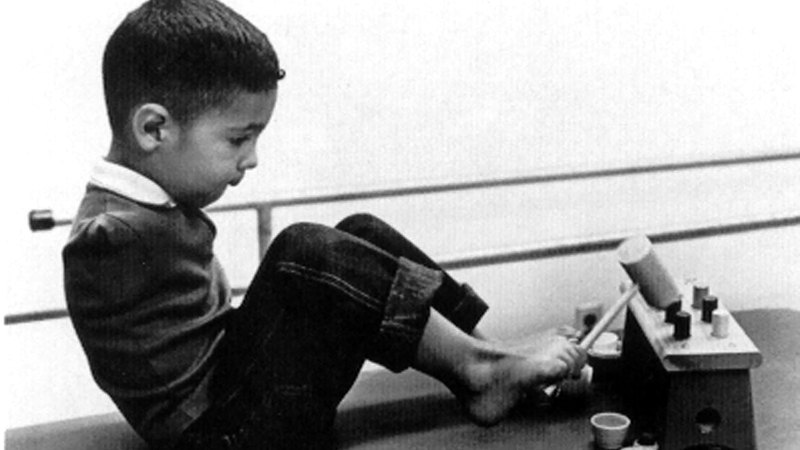 أطفال أصابهم التشوّه بعد تناول أمهاتهم عقار ثاليدوميد.  من المصدر