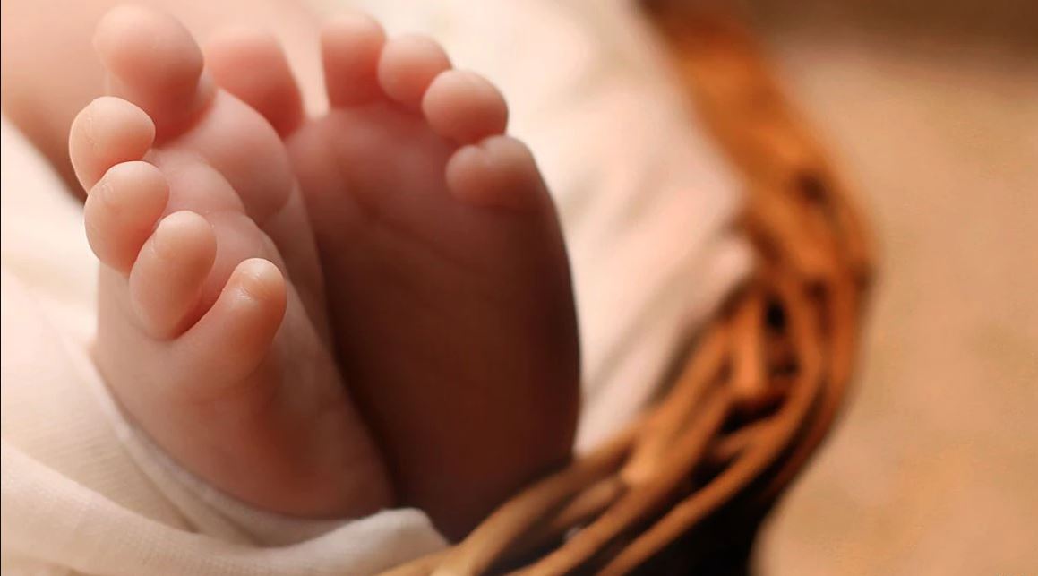 Born with four arms and four legs, a sensation in India Teller Report