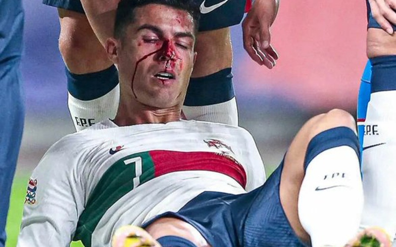 الصورة: كريستيانو رونالدو يتعرض لإصابة قوية في مباراة البرتغال والتشيك (فيديو وصور)