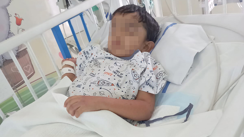 الطفل محمد يرقد في المستشفى بعد إجراء الجراحة. من المصدر