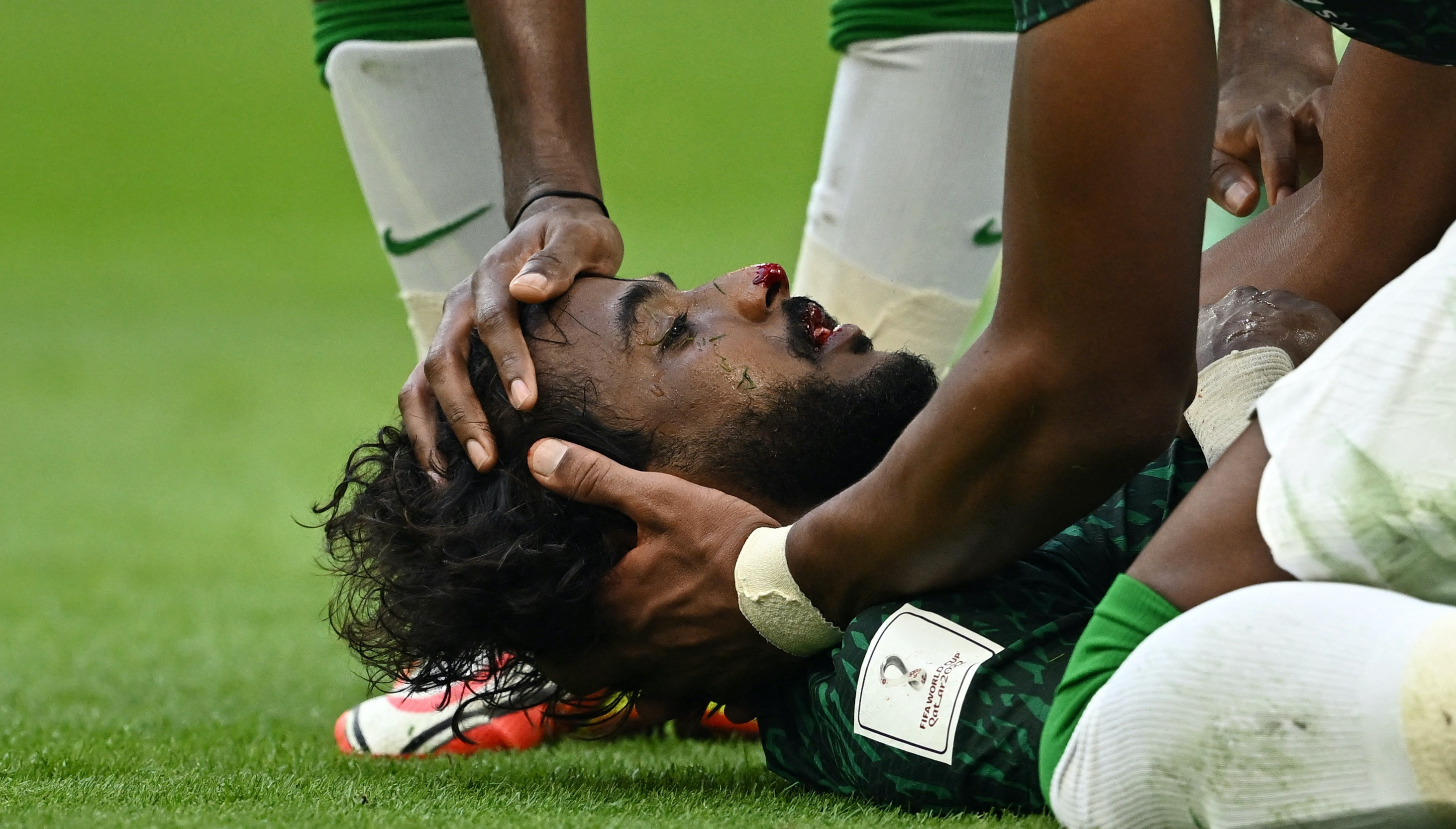 Суперкубок саудовской аравии по футболу. Саид Аль-Овайран. Ясир Аль Шахрани. Травма футболиста Саудовской Аравии.