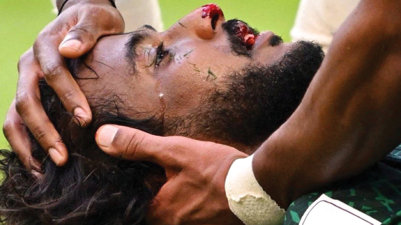 إصابة ياسر الشهراني في الفك.
