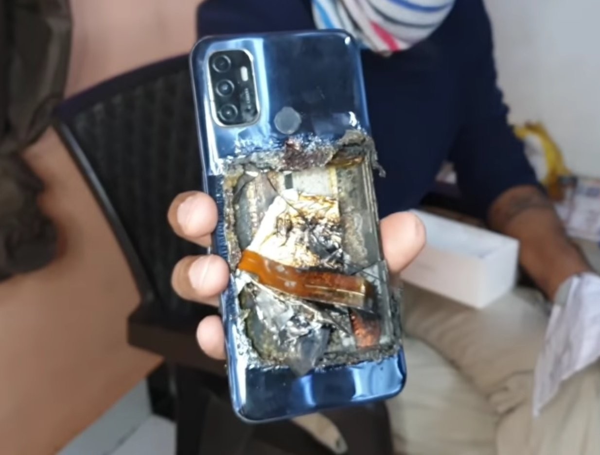 קשיש ניצל לאחר שהטלפון הנייד שלו התפוצץ בתוך כיס חולצתו (וידאו)