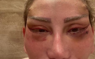 الصورة: ريهام سعيد تفجر مفاجأة جديدة بعد تشويه وجهها ومستشفى سعودي يبادر إلى علاجها