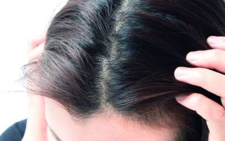 الصورة: أطباء يحذّرون من استخدام «منشطات» لعلاج أمراض الشعر