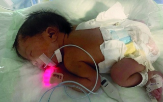الصورة: أسرة الرضيع «كريم» تعجز عن سداد 68 ألف درهم كُلفة عمليته الجراحية