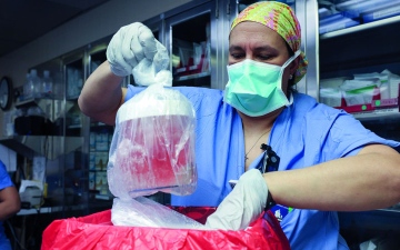 الصورة: صحة.. أول مريض يخضع لزراعة كلية خنزير معدلة.. يفتح باباً للأمل ويرحل
