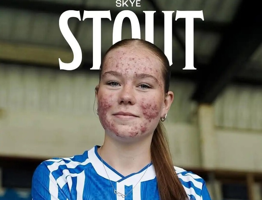 حفل تقديم لاعبة كرة قدم يتحول إلى كابوس.. وتصرف غريب من النادي!