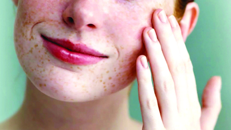 البشرة الجافة تحدٍّ شائع يؤثر في حياة الكثير من الأشخاص. أرشيفية