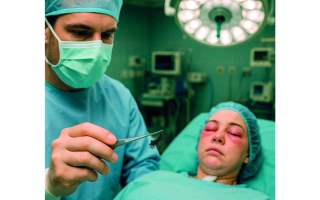 الصورة: «تريند الرموش الاصطناعية».. لواصق «مجهولة» تحرق العيون