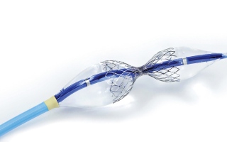 الصورة: «كليفلاند كلينك» يجري أول عملية لزرع جهاز يخفف آلام الذبحة الصدرية