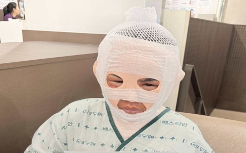 الصورة: كي يجعلها بشعة ولا ترتبط بغيره.. رجل يسكب الماء المغلي على وجه صديقته