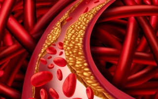 الصورة: أدوية ارتفاع الكوليسترول وآلام العضلات.. ما البديل؟