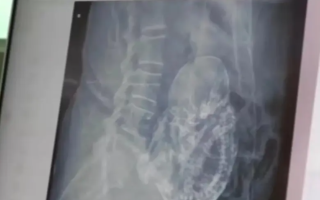 الصورة: امرأة ثمانينية حامل .. والجنين عمره 40 عاماً