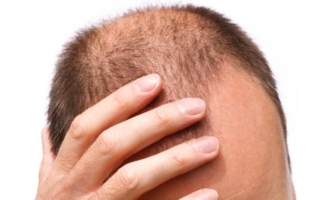 الصورة: هندية ترفع دعوى ضد زوجها بعدما تبين لها أنه أصلع