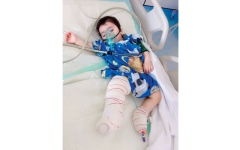 الصورة: الرضيع &laquo;شاهين&raquo; يعاني حروقاً من الدرجة الثانية.. ويحتاج 34.7 ألف درهم للعلاج