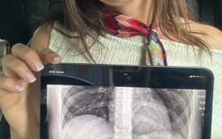 الصورة: امرأة تبتلع ملعقة طعام بعد أن قفز كلبها فجأة إلى حضنها