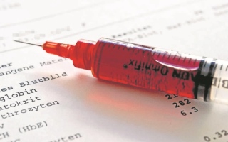 الصورة: فحوصات دم بسيطة تُنبئ بالأمراض المزمنة مبكراً.. عبر 7 مؤشرات