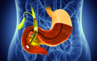 الصورة: مرضى المرارة في رمضان .. الصيام ممكن ولكن بهذه الشروط