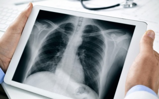 الصورة: رجل يتمكن من العيش 48 ساعة بدون رئتين